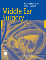 Middle_ear_surgery (2).pdf